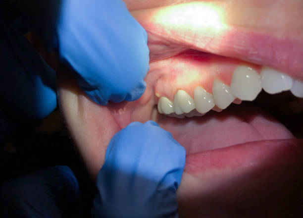 Best Weekend Emergency Dentist in Texanna, OK