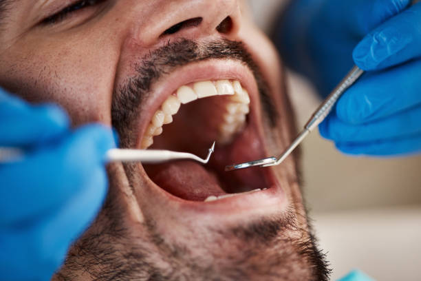 Best 24-Hour Emergency Dentist in Texanna, OK